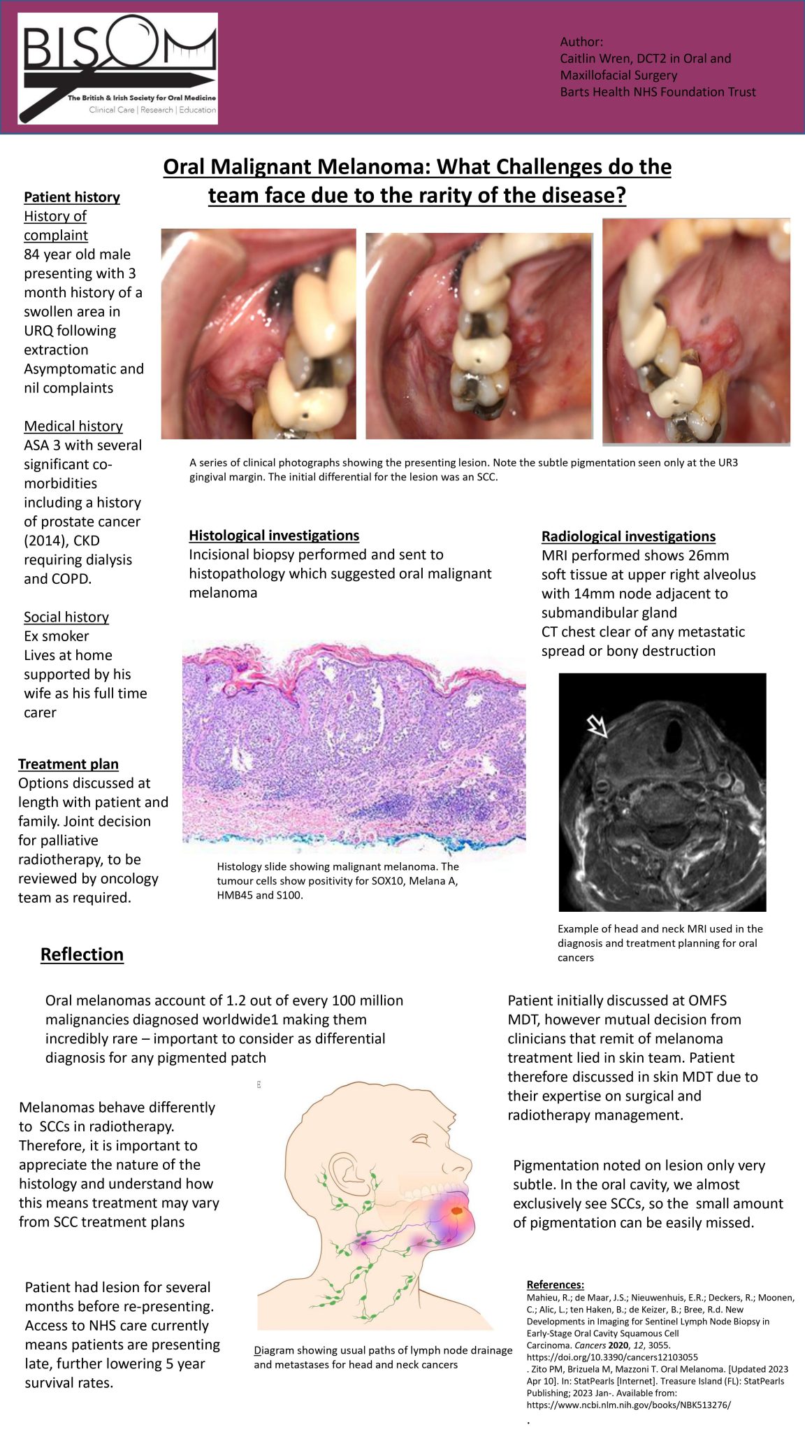 oral-malignant-melanoma-poster-bisom-1