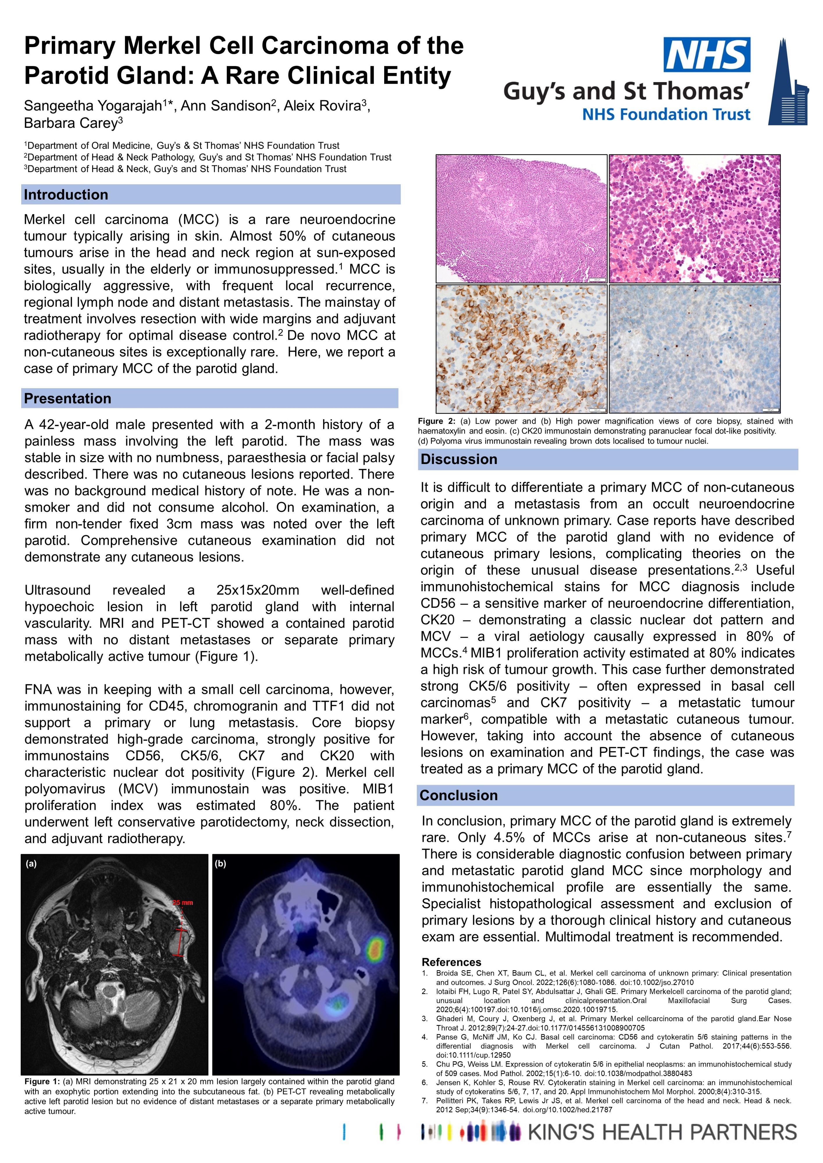 BISOM-2024-A0-Merkel-cell-carcinoma.BC_.SY_