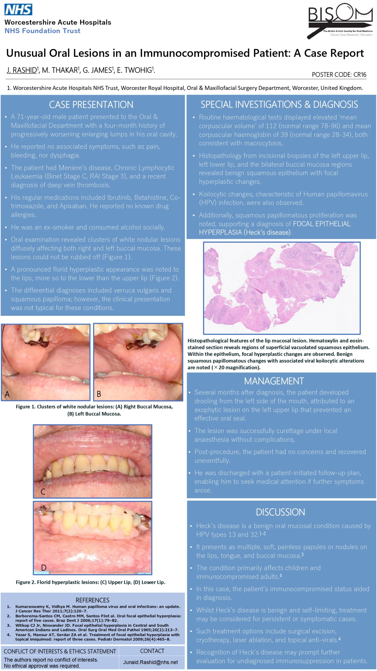Unusual-Oral-Lesions-in-an-Immunocompromised-Patient-A-Case-Report