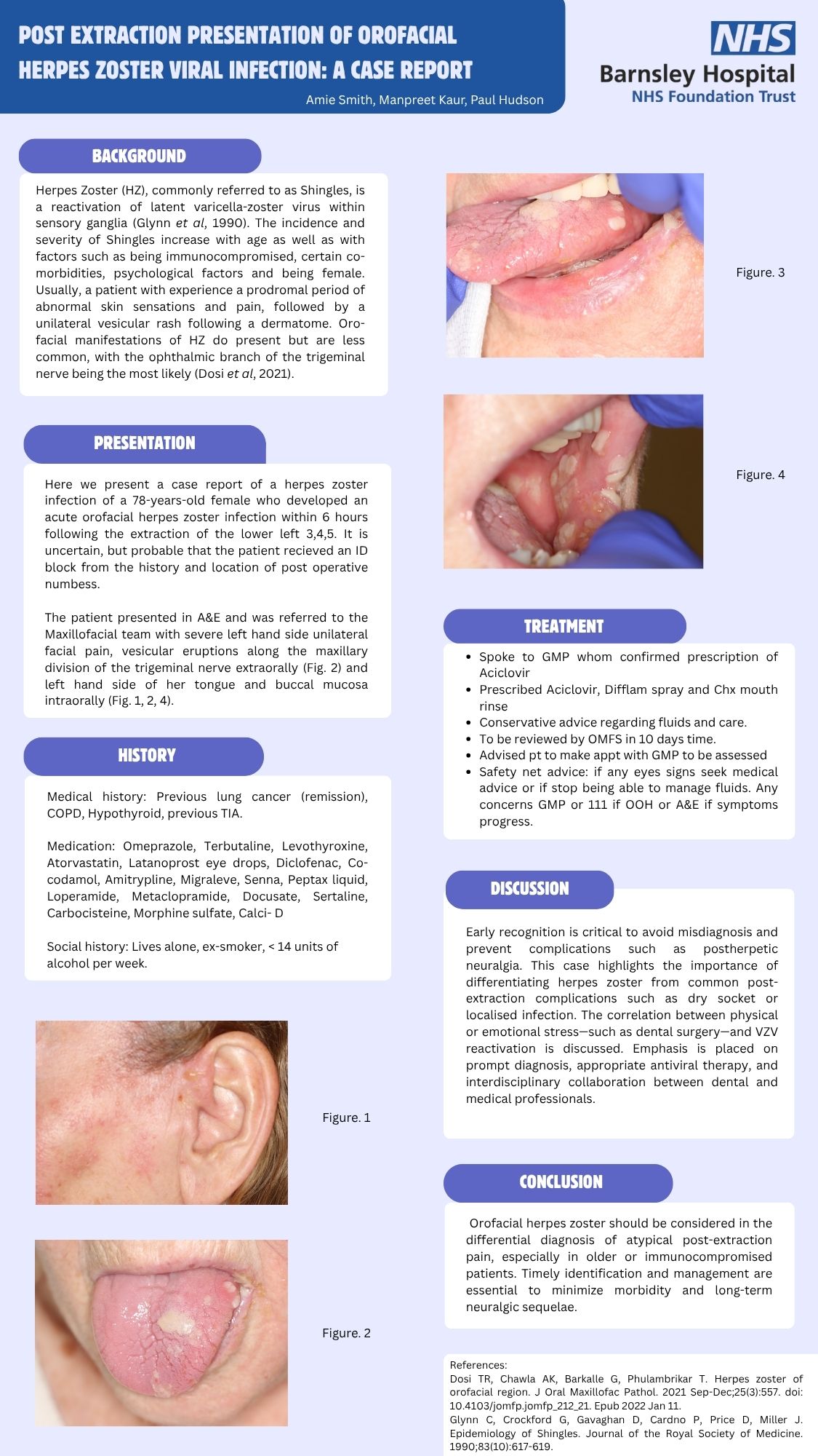 Academic-Research-Poster-in-Blue-and-White-Contemporary-Style-28.575-x-50.8-cm