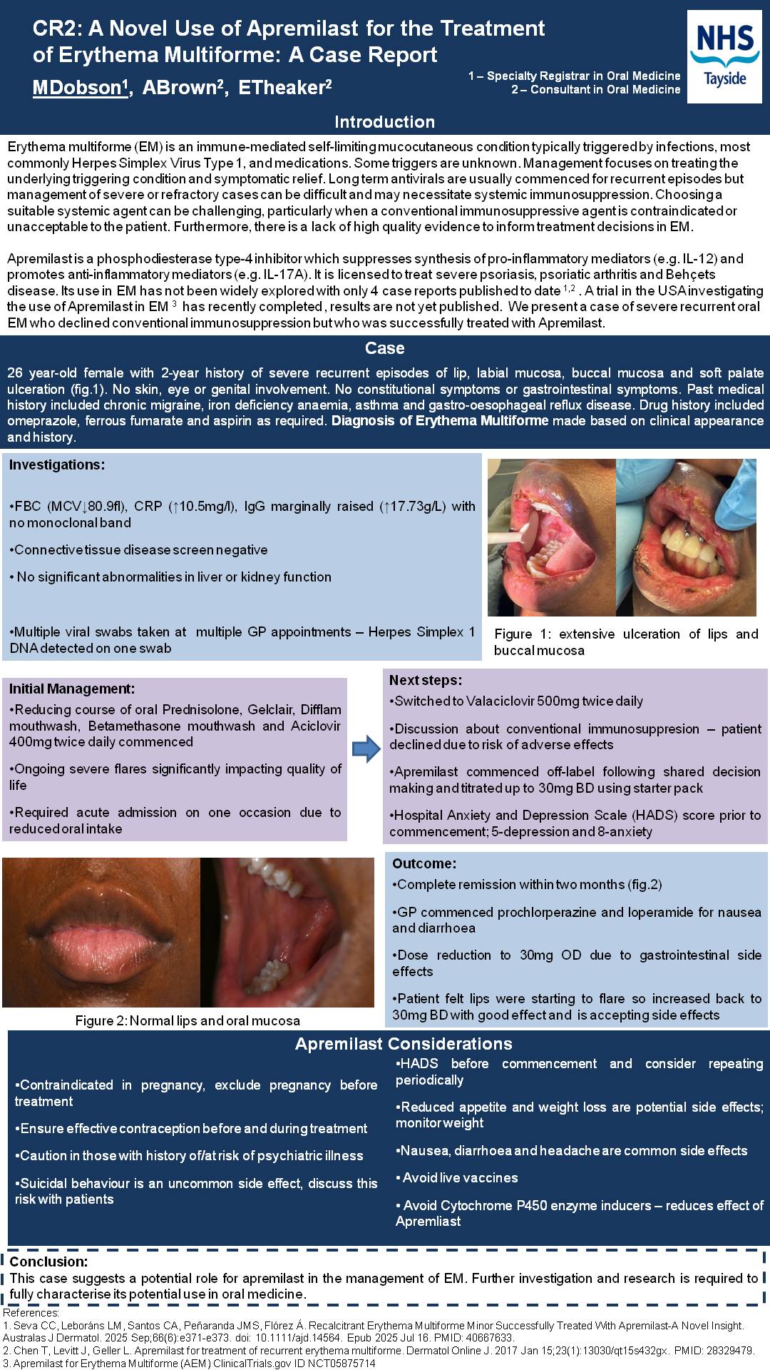 CR2-MDobson-A-Novel-Use-of-Apremilast-for-the-Treatment-of-Erythema-Multiforme-A-Case-Report-jpeg