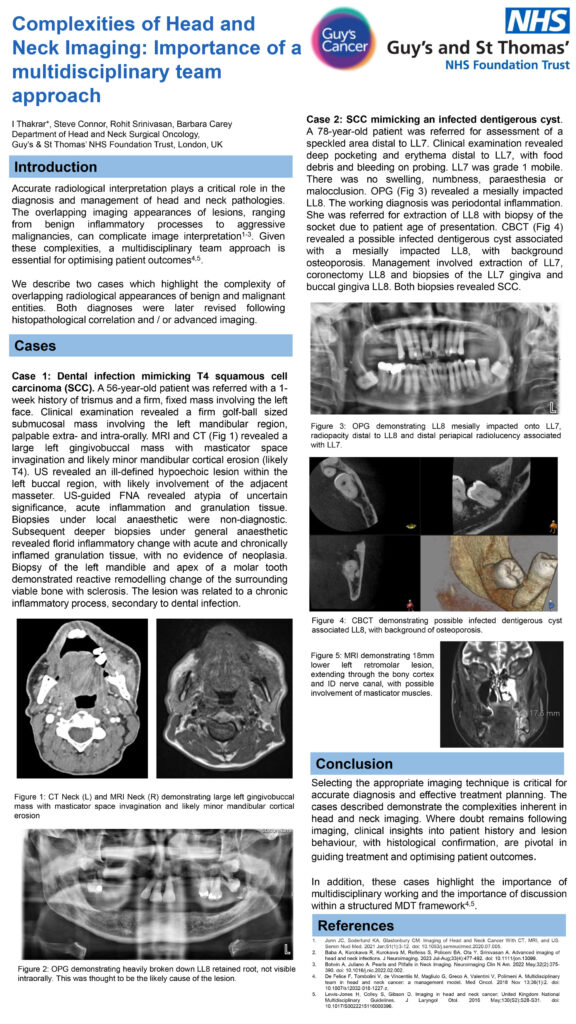 Complexities of Head and Neck Imaging: Importance of a multidisciplinary team approach