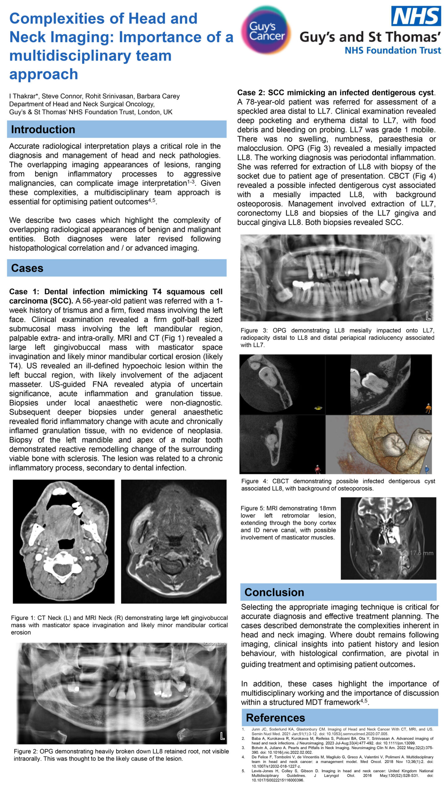 Complexities of Head and Neck Imaging: Importance of a multidisciplinary team approach