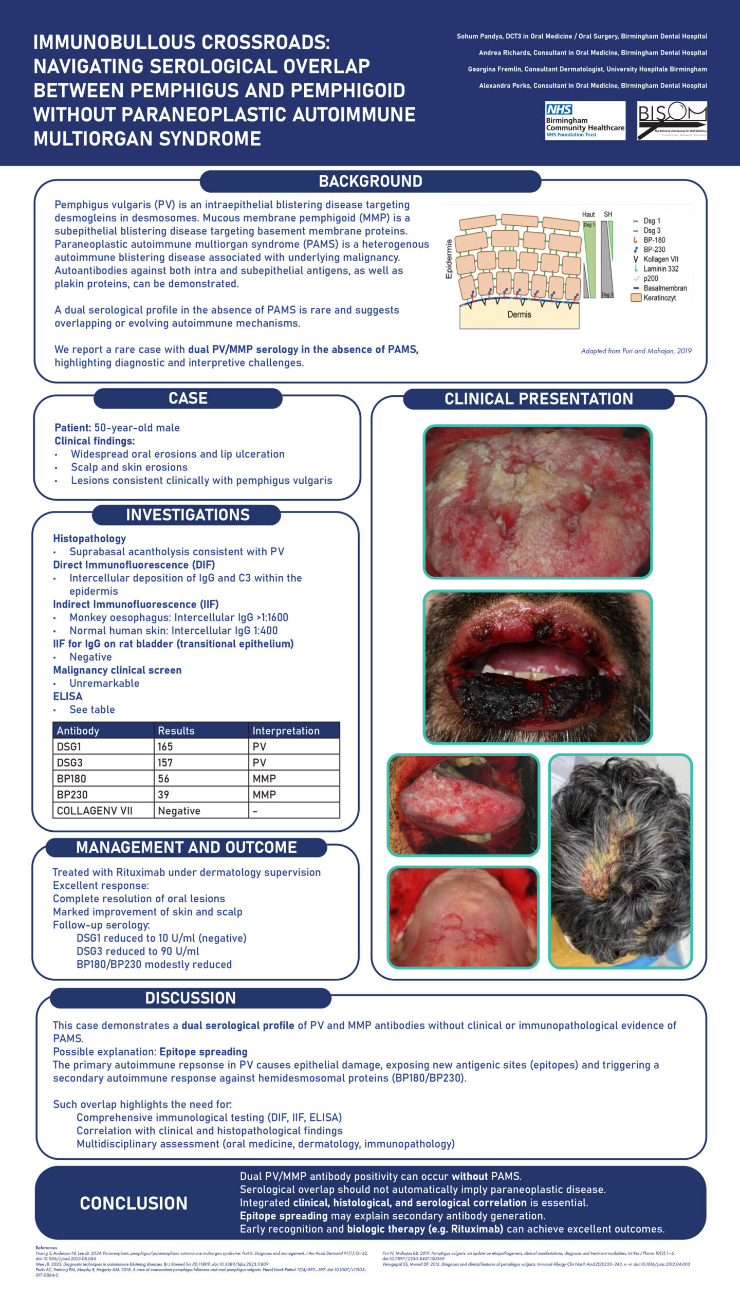 Immunobullous Crossroads: Navigating Serological Overlap Between Pemphigus and Pemphigoid Without Paraneoplastic Autoimmune Multiorgan Syndrome